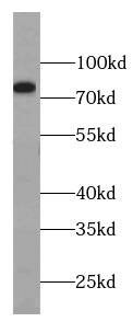 MYSM1 Antibody - BSA Free