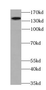 MYPN Antibody - BSA Free