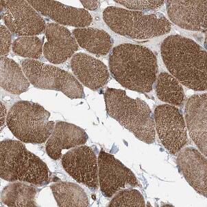 myozenin 3 Antibody - BSA Free