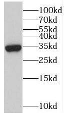 myozenin 3 Antibody - BSA Free