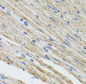 Myotilin Antibody - BSA Free