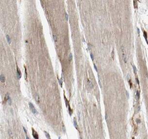 MYOM1 Antibody - BSA Free