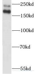 MYO18A Antibody - BSA Free
