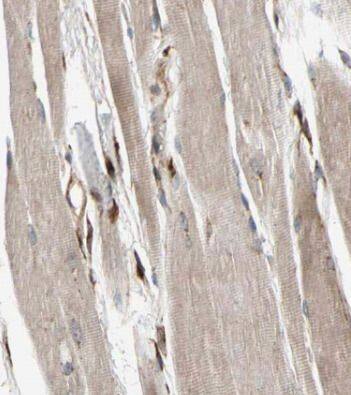 Fast skeletal myosin light chain 2 Antibody - BSA Free