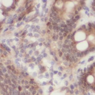 MYLK3 Antibody - BSA Free