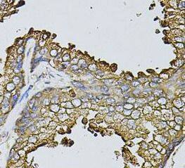 Fast skeletal myosin light chain 1 Antibody - BSA Free