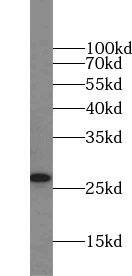 Fast skeletal myosin light chain 1 Antibody - BSA Free