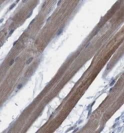 MYH4 Antibody - BSA Free