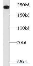 Myosin heavy chain 14 Antibody - BSA Free