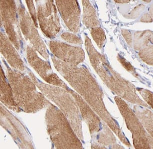 Myosin Heavy Chain 1 Antibody - BSA Free