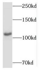 MYCBPAP Antibody - BSA Free