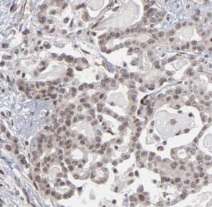 MYCBP Antibody - BSA Free