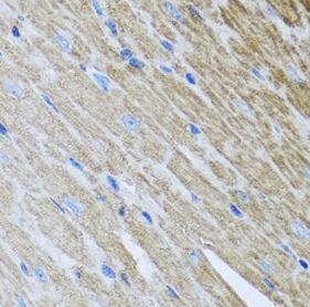 Metaxin-2 Antibody - BSA Free