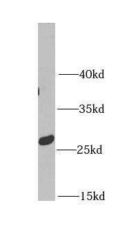 Metaxin-2 Antibody - BSA Free