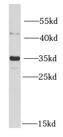 Metaxin 1 Antibody - BSA Free