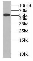 MTMR8 Antibody - BSA Free
