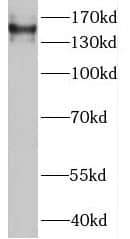 MTMR4 Antibody - BSA Free