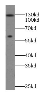 MTMR15 Antibody - BSA Free