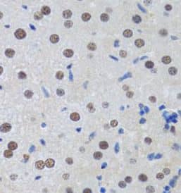 MTA3 Antibody - BSA Free