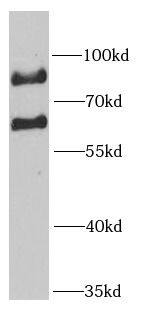 MTA3 Antibody - BSA Free