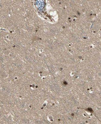 Metallothionein-3 Antibody - BSA Free