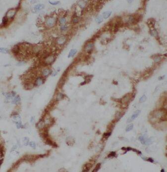 MRPS17 Antibody - BSA Free