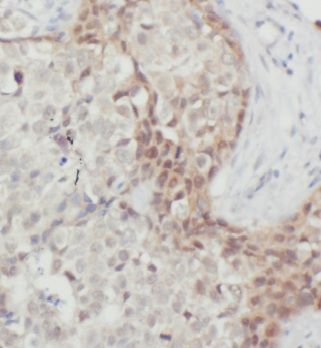 MRPL9 Antibody - BSA Free