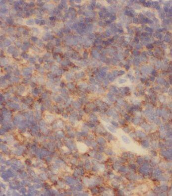 MRPL37 Antibody - BSA Free