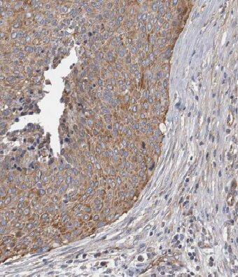 MRPL3 Antibody - BSA Free