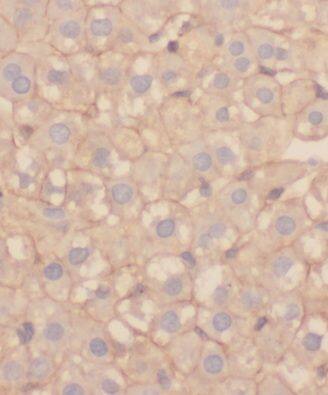 MRPL21 Antibody - BSA Free