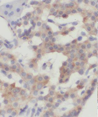 MRPL14 Antibody - BSA Free