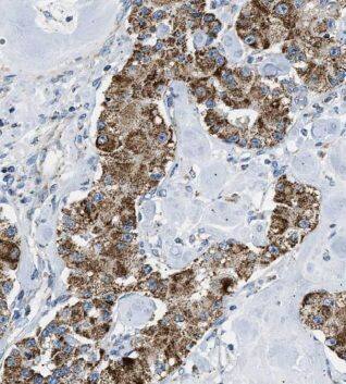 MRPL13 Antibody - BSA Free