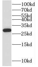 MRPL10 Antibody - BSA Free