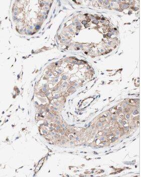 MRPL10 Antibody - BSA Free