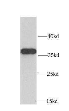 MRPL1 Antibody - BSA Free