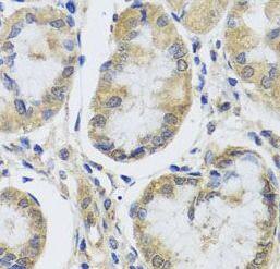 MRPL1 Antibody - BSA Free
