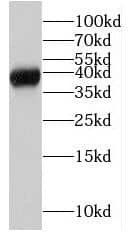 MRM1 Antibody - BSA Free