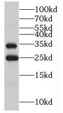 EVA1/MPZL2 Antibody - BSA Free