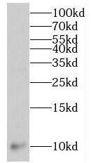 MPV17L Antibody - BSA Free