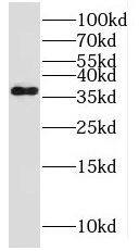 MPPED1 Antibody - BSA Free
