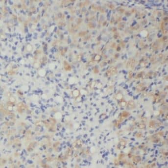 MPP7 Antibody - BSA Free