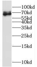 MPP7 Antibody - BSA Free