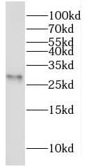 MOSPD3 Antibody - BSA Free