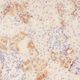 MOGAT2 Antibody - BSA Free