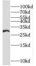 MOGAT2 Antibody - BSA Free