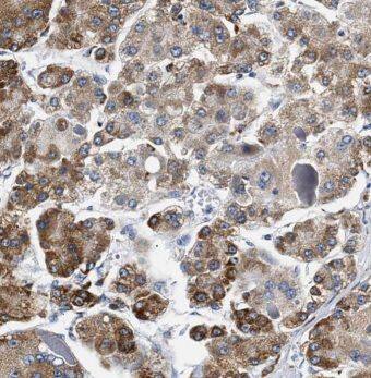 MOGAT1 Antibody - BSA Free