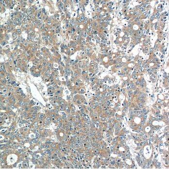 MOBKL3 Antibody - BSA Free