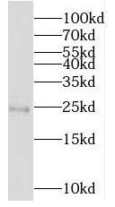 MOBKL3 Antibody - BSA Free