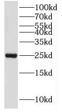 MOBKL2A Antibody - BSA Free