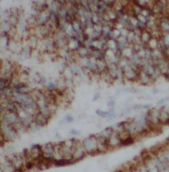 UEV2 Antibody - BSA Free